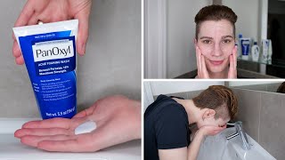 How to use PanOxyl 10 Benzoyl Peroxide Acne Foaming Wash [upl. by Eigla]