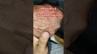 Amoxicillin amp potassium Calvuanate injection ipshrort trending medicalprocedure drxsachin12 [upl. by Renruojos]