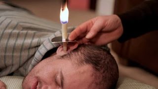 The danger of ear candling [upl. by Llenad]