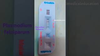 Plasmodium falciparum under microscope 🔬🧪🩸bloodallindiainstituteofmedicalscience [upl. by Atener]