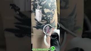 TwoStep Tattoo Removal CO2 Laser amp PicoSecond Laser Explained [upl. by Atneuqal]