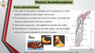 Phylum Acanthocephala [upl. by Antonio]