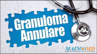 Granuloma Annulare ¦ Treatment and Symptoms [upl. by Pride]