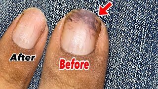 How to Remove Hair Dye from Nails the easy way [upl. by Hegarty628]