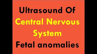 Ultrasound of CNS foetal anomalies [upl. by Hewe]