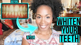 How to Whiten Teeth FAST amp NATURALLY  SIMPLE Cleaning amp Teeth Brushing Routine [upl. by Hsital]