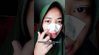 masker komedo terenak ga bikin sakit shorts shortvideo youtubeshorts subscribe fyp short [upl. by Ysdnyl]