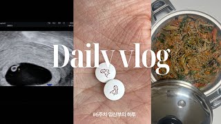 6주차 임산부의 VLOG [upl. by Ilajna820]