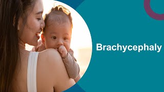 Brachycephaly Positioning for your baby [upl. by Saffren]