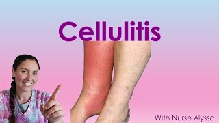 Cellulitis [upl. by Ynnohj]