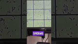 Identifying Sperm Motile vs Immotile Live Demonstration [upl. by Lati]