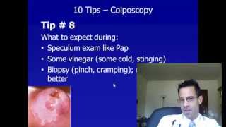 Colposcopy  To Tips to Know What to Expect and Know How To Prevent Cervical Cancer [upl. by Mlohsihc166]