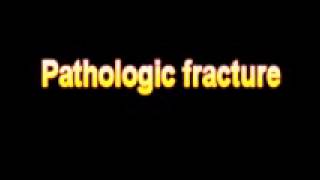 What Is The Definition Of Pathologic fracture Medical School Terminology Dictionary [upl. by Durham]