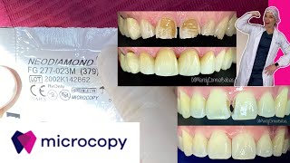 Como usar las FRESAS DENTALES  Colaboración con MICROCOPY DENTAL [upl. by Leinod]