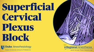 Superficial cervical plexus block [upl. by Haley]