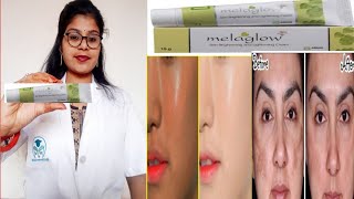 Best Skin Lightening Melaglow cream honest review  Melaglow skin cream benefits uses review inhindi [upl. by Ariem]