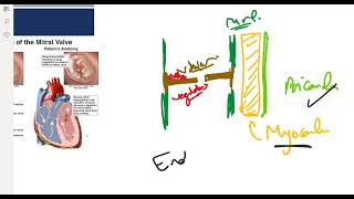 Infective Endocarditis [upl. by Tra]