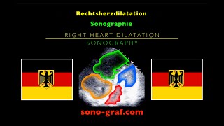 Echokardiographie  Rechtsherzdilatation [upl. by Acired]