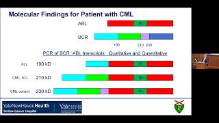 Yale Cancer Center Grand RoundsSturges Lecture in Hematology  June 7 2024 [upl. by Gerrilee]