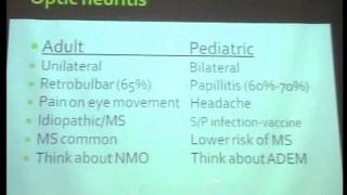 Childhood optic neuritis [upl. by Mosby22]