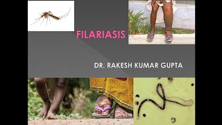 Filariasis cause symptoms diagnosis and treatment [upl. by Maje171]