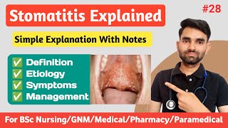 Stomatitis in Hindi  Causes Symptoms And Management of Stomatitis [upl. by Acinoed579]