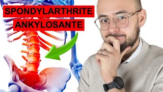 La Spondylarthrite ankylosante  les symptomes dun mal de dos pas comme les autres [upl. by Ariahs]