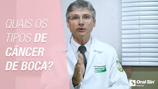 Quais os tipos de câncer de boca  Previnase para Sorrir  Oral Sin Implantes [upl. by Aihtyc]