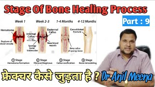 Bone fractures healing process  Fracture bone healing time  Fracture bone Repair  in Hindi [upl. by Marks]