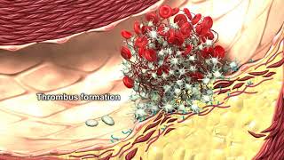 The Role of Autophagy in Thrombus Formation [upl. by Eiten]