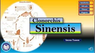 Clonorchis sinensis causes hyperplasia amp fibrosis of biliary tract  Parasitology  by Imran Yaseen [upl. by Fleeta]