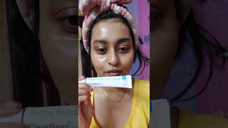 I tried Benzoyl peroxide gel for the 1st time and this happened [upl. by Dixil]