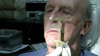 Dentures  Wax Rim Appointment  Wax esthetics speech CR VDO [upl. by Ellerehs]