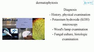 dermatophytosis [upl. by Birkle]