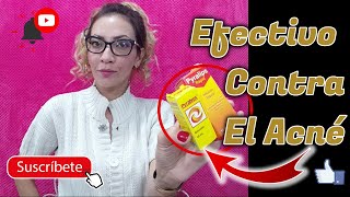 Productos Efectivos Para Quitar El Acné Pyralvex Vs Pyralips [upl. by Schapira779]