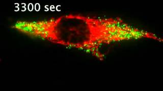 More dynamics of peroxisomes and mitochondira [upl. by Aenaj]