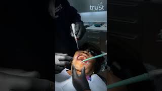 Surgical Technique of Immediate Placement [upl. by Wendalyn]