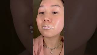 POV your skin is congested kbeauty [upl. by Minnnie]