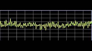 Asperger Syndrome  Rife Frequencies [upl. by Gefen]