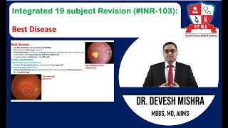 🕉 Integrated 19 subject Revision INR103Best Disease by Dr Devesh Mishra [upl. by Jonati]