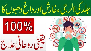 Jild Ki AllergyKharish Aur Daag Dhabe Ka 100 Yaqeeni Rohani Ilaj  Naqsh For Skin Allergy [upl. by Naesar]