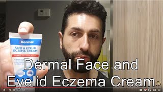 Check out Ramios video about our Face amp Eyelid Eczema Cream httpsyoutubeidhbfdAHoo [upl. by Ahcurb186]