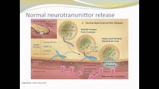 Spasticity and Telerehabilitation [upl. by Lohrman]