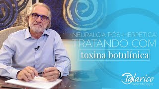 Neuralgia pósherpética tratando com toxina botulínica [upl. by Aratak]