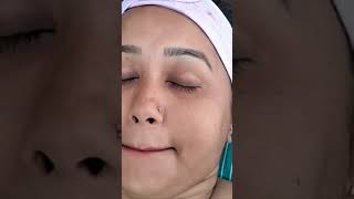 EXTRAglowmudfacial openporesclosereducepigmentationreducedullness facial newlaunch glowup [upl. by Anaira]