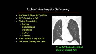 Alpha1 Antitrypsin Deficiency 101 Lung [upl. by Justin]