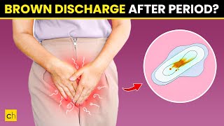 How To Stop Brown Discharge After Period  Causes amp Natural Remedies [upl. by Esertap522]