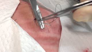 Vertical Mattress Sutures [upl. by Whitford]