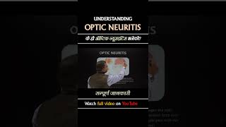 Optic Neuritis neurologist [upl. by Akela]