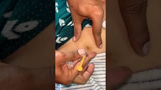 How to give SC injection 💉😱docter trendingshorts viralshorts [upl. by Anidan922]